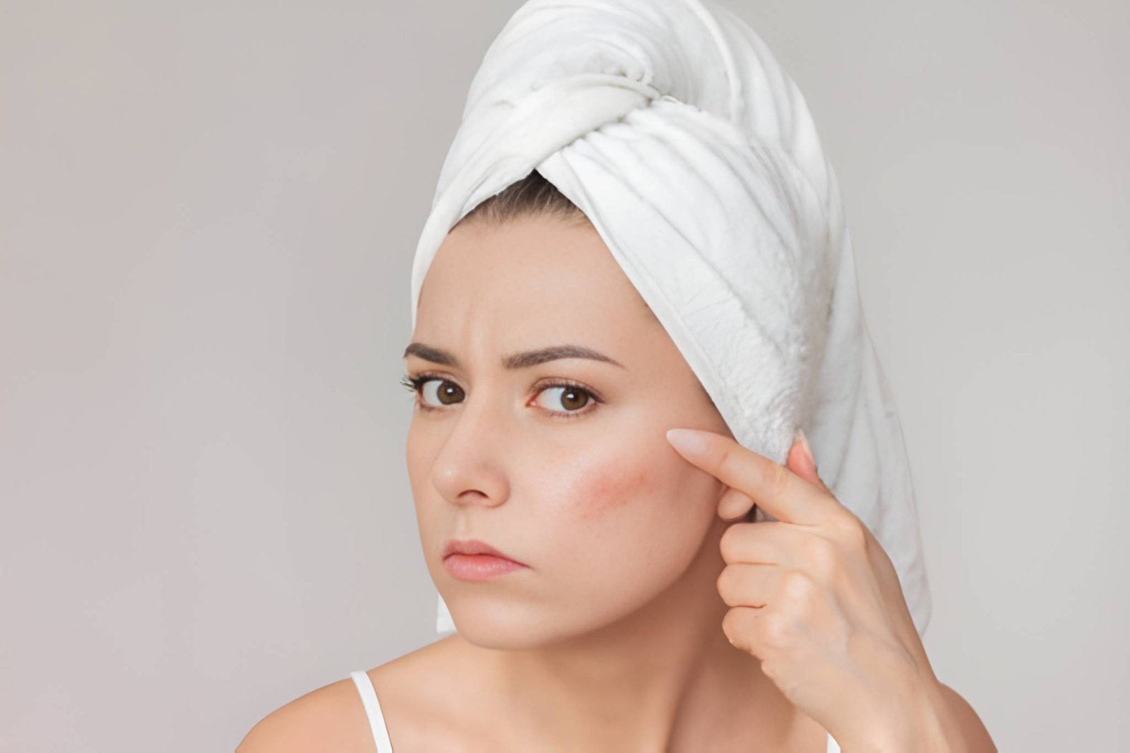 Erythematotelangiectatic rosacea treatment in Delhi