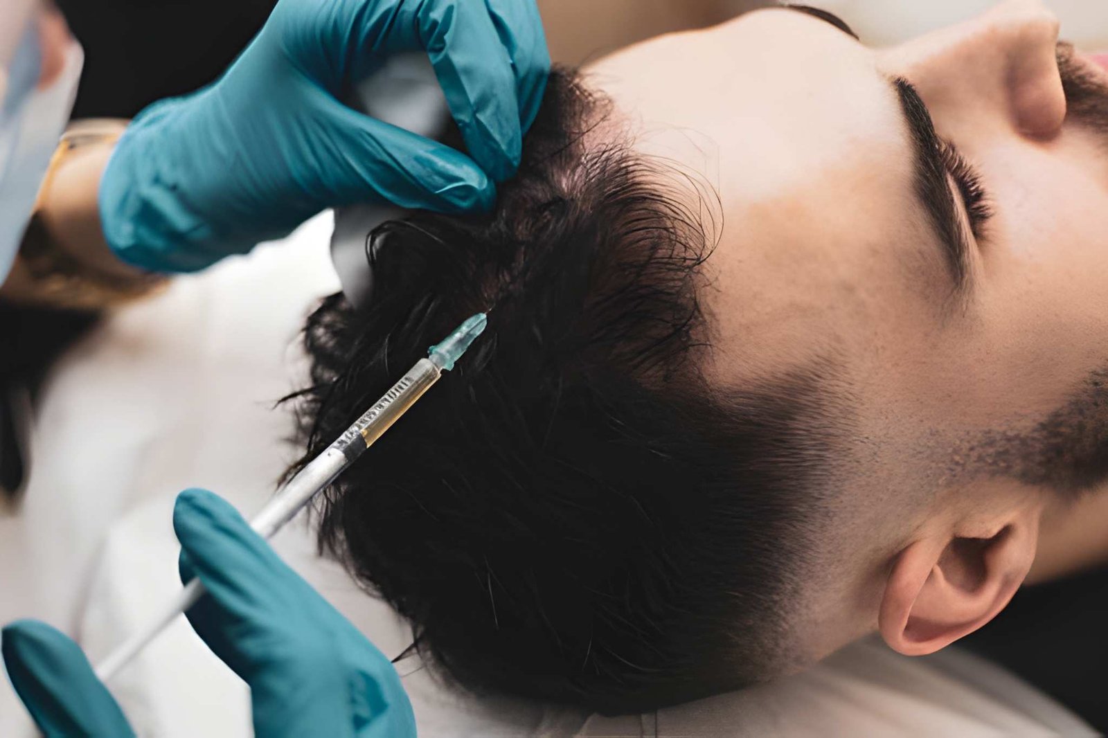 MESOTHERAPY FOR MEN HAIR LOSS