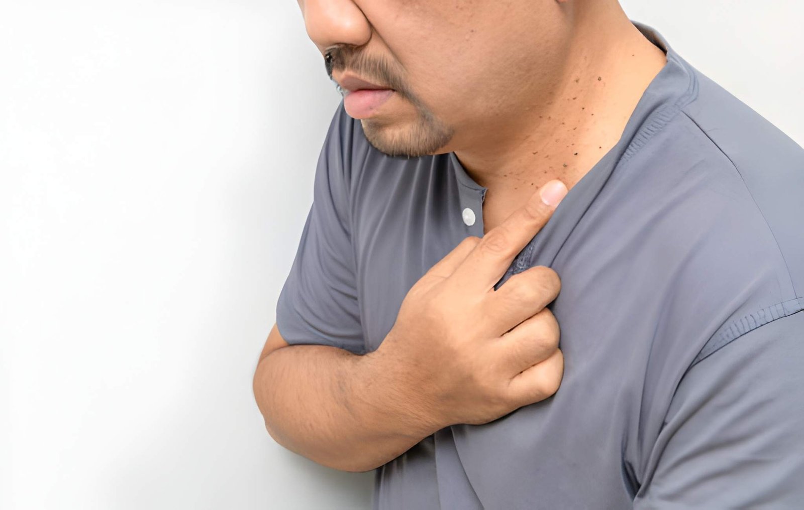 Neck skin tags treated with skin tag removal treatment in Delhi