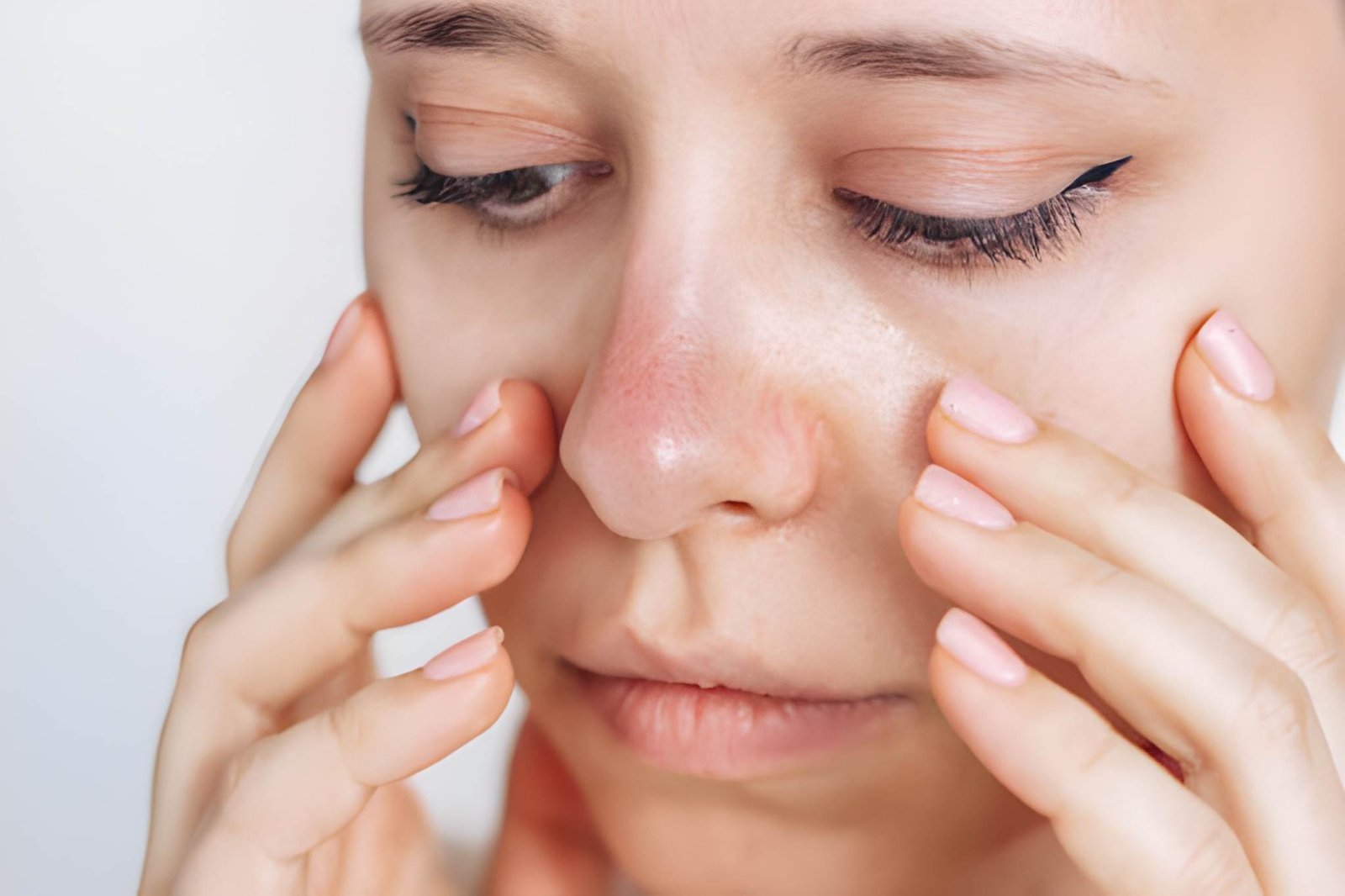 Ocular rosacea symptoms and treatment in Delhi
