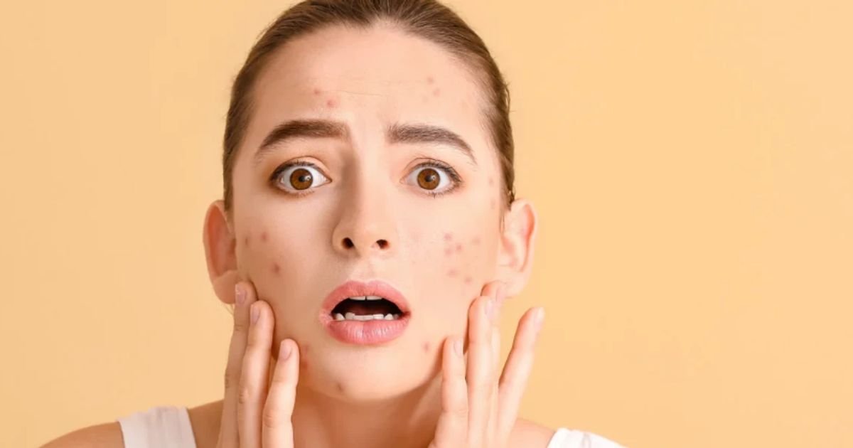 Symptoms of dark spots on the skin