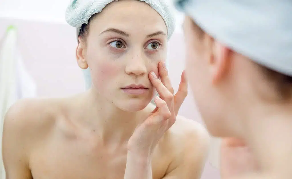 Under eye dark circles and pigmentation around the eyes