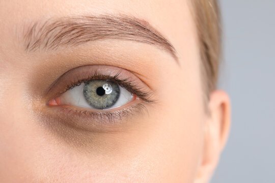 Moderate dark circles treatment in Delhi