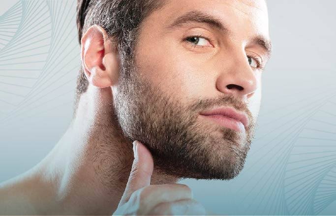 Beard transplant in Delhi at Skinfollix