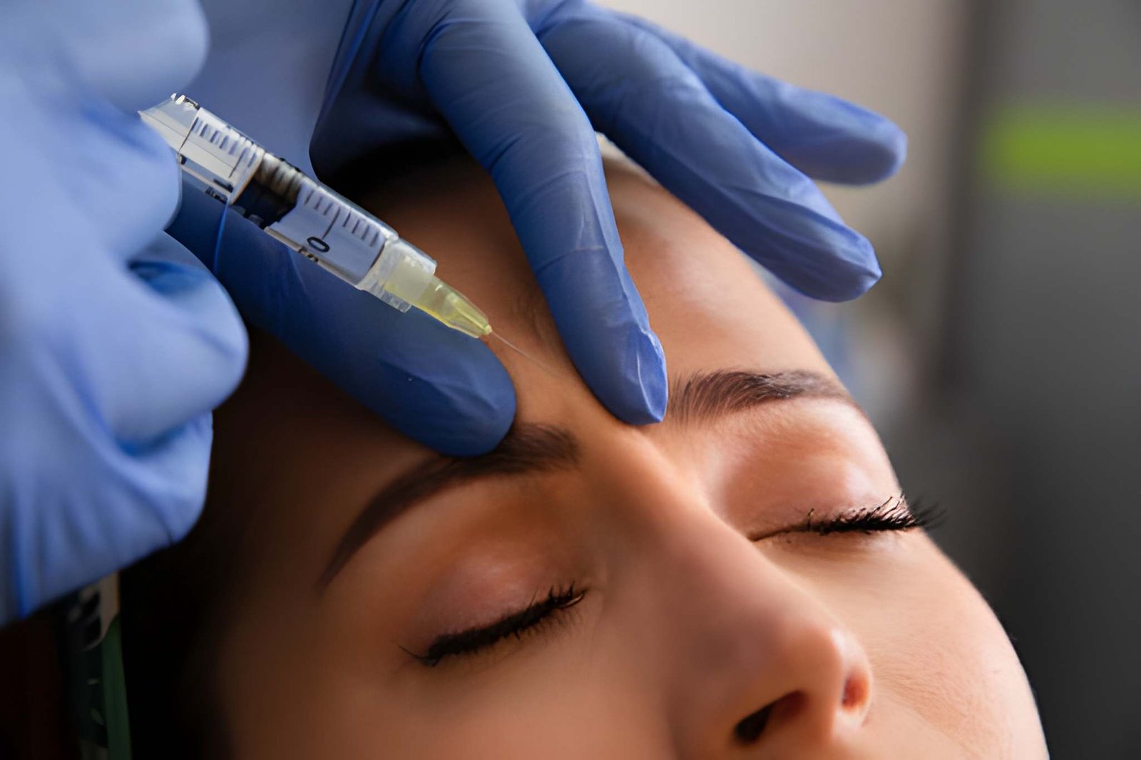 Botox treatment in Delhi at Skinfollix