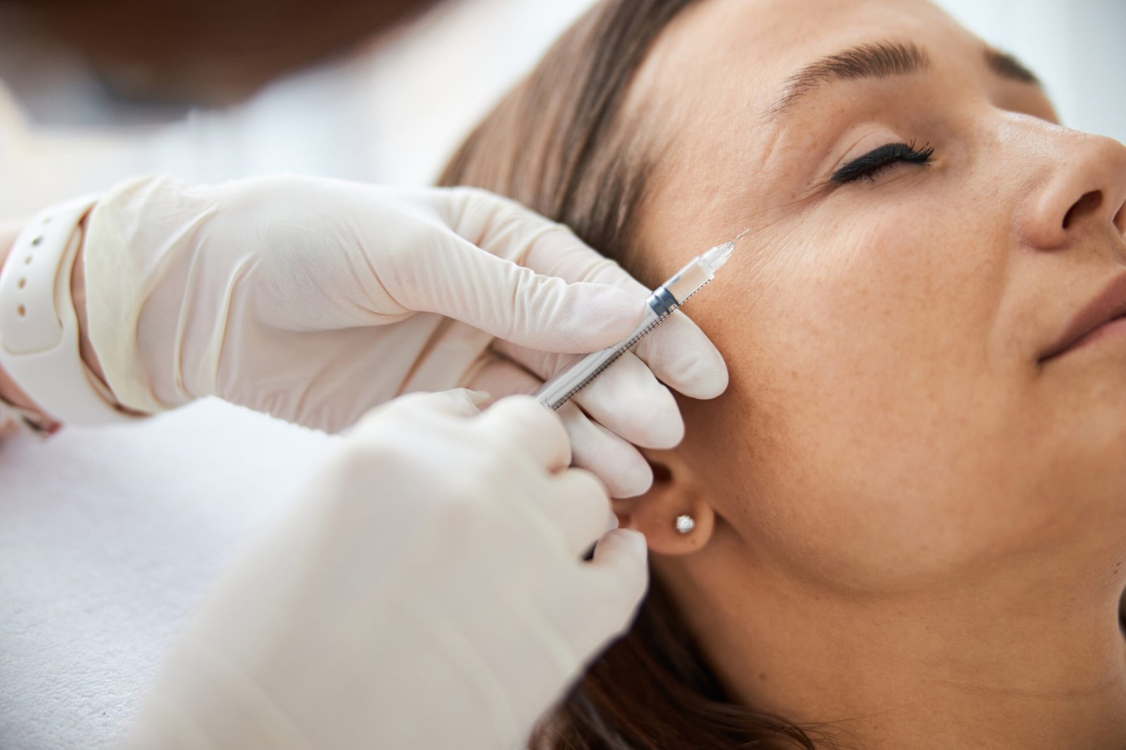 Botox treatment by Dr. Vijay Soyal, dermatologist in Delhi