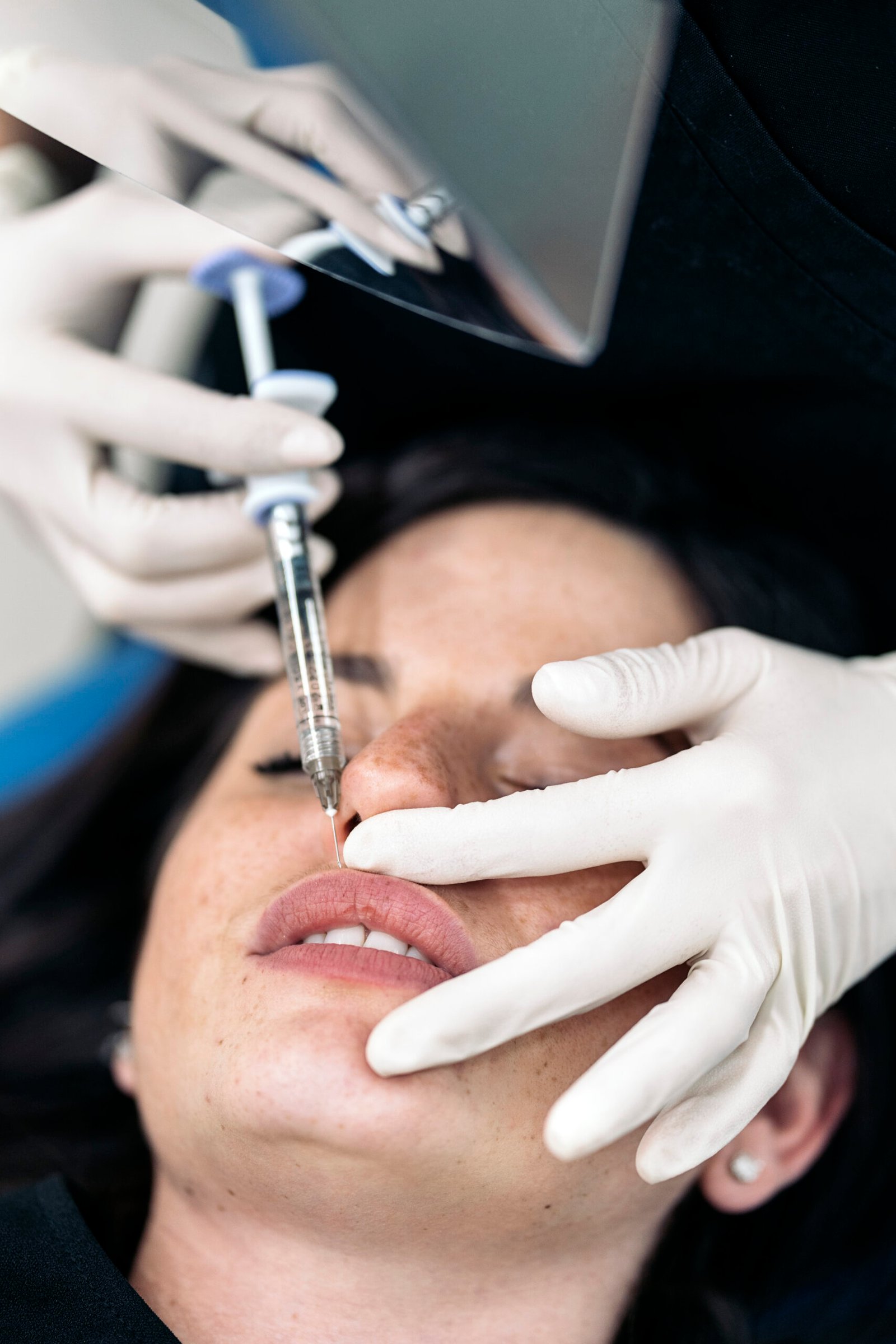 Dermal filler treatment by Dr. Vijay Soyal, dermatologist in Delhi
