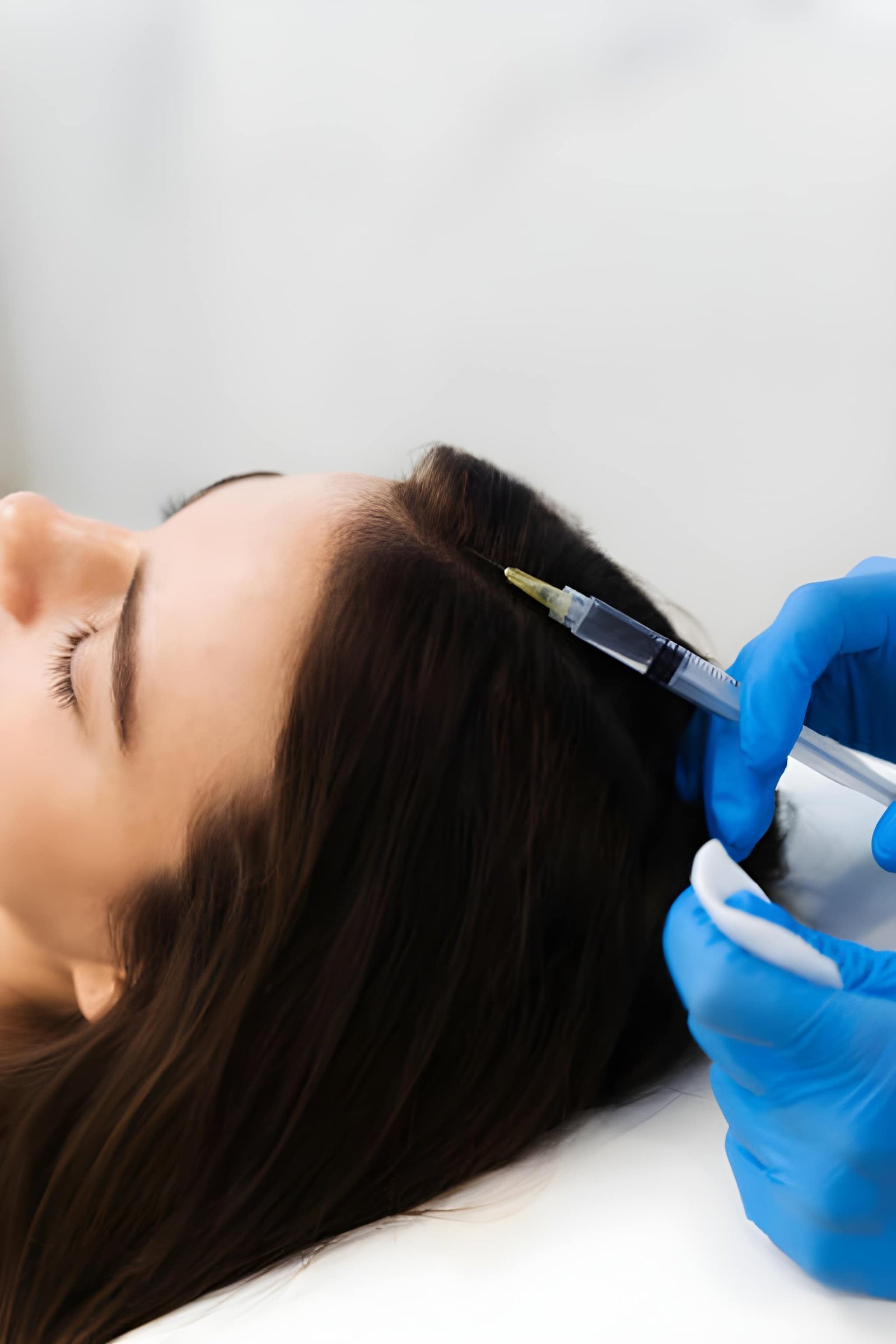 Exosome hair treatment in Delhi at Skinfollix