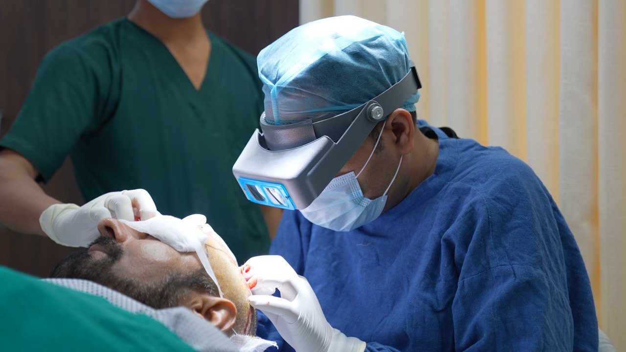 FUE and DHI hair transplant for hair regrowth in Delhi