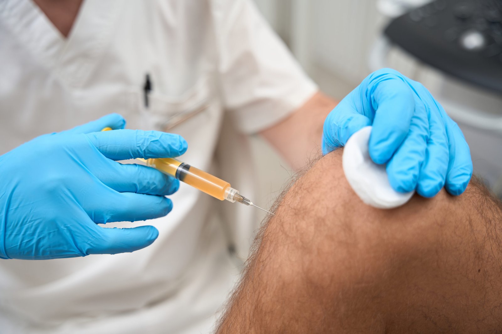 GFC hair treatment in Delhi at Skinfollix Hair & Dermatology Clinic