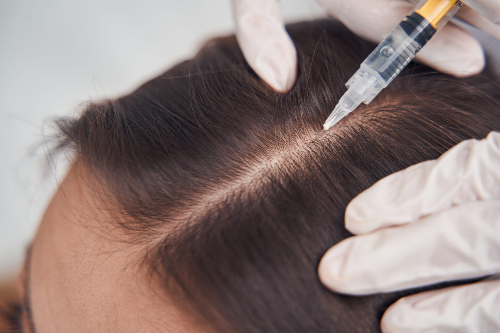 GFC candidacy assessment and diagnosis at Skinfollix
