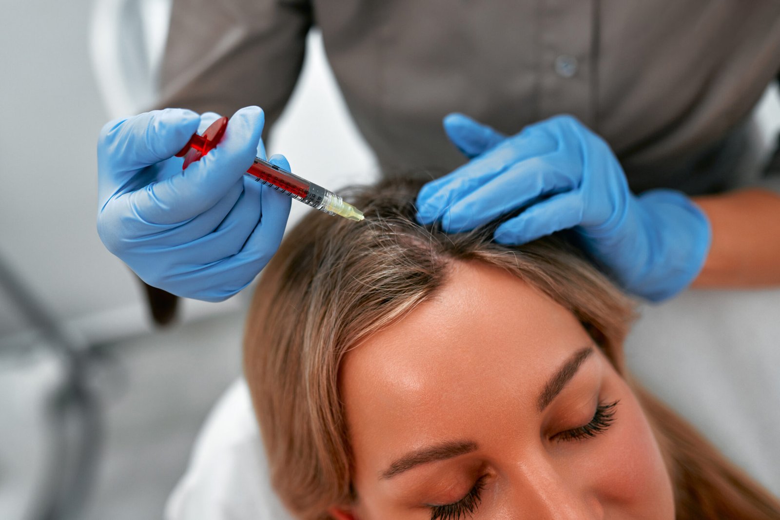 GFC hair treatment for hair thinning and hair loss