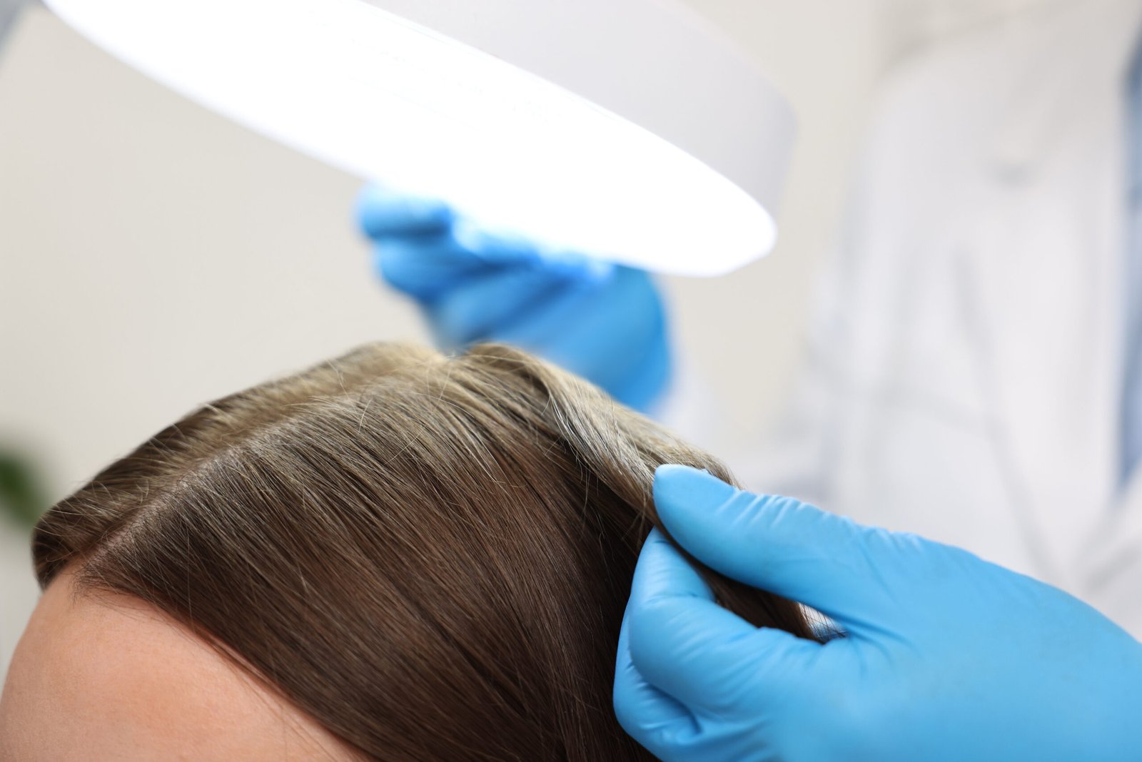 Hair growth therapy in Delhi at Skinfollix