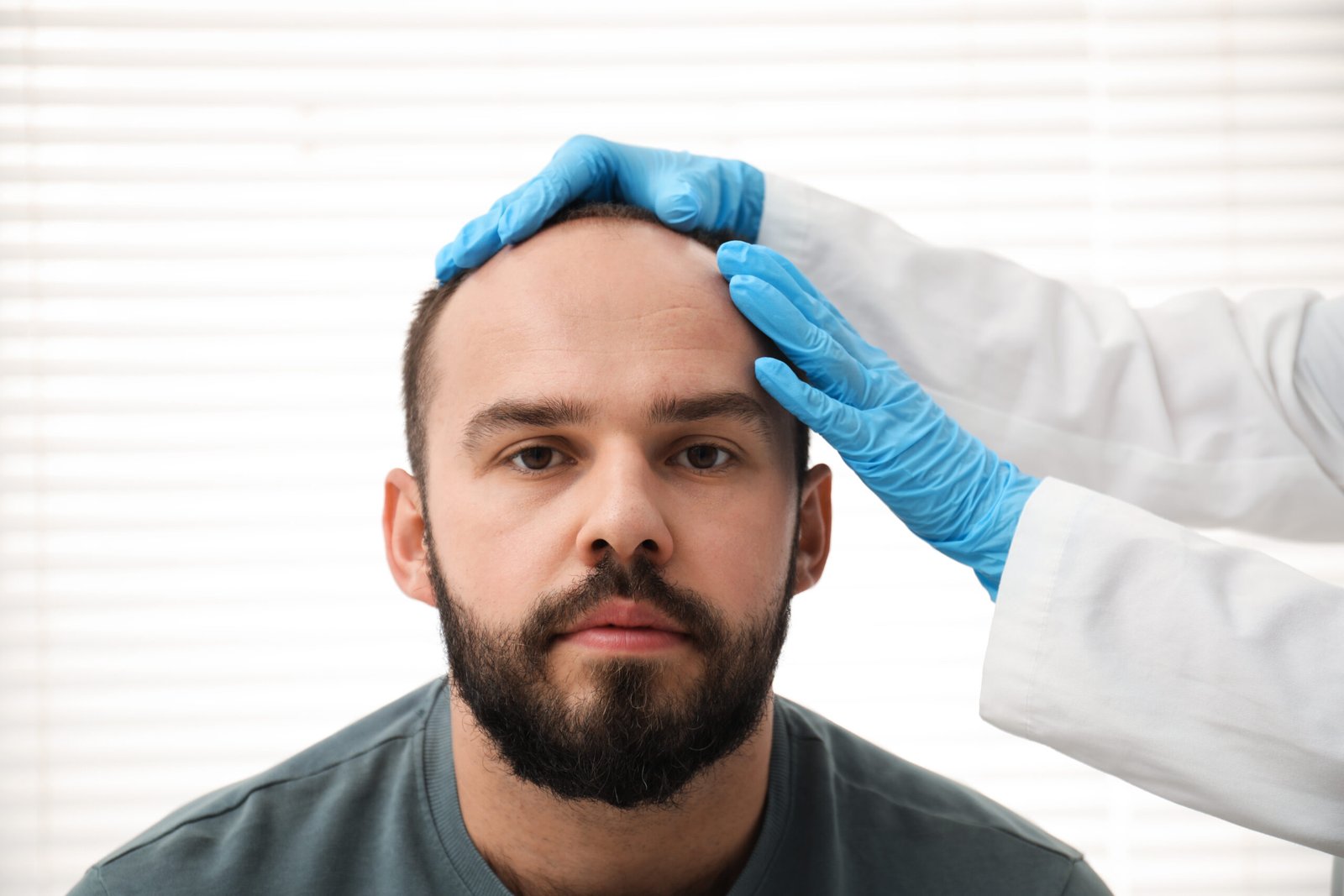 Hair transplant in Delhi at Skinfollix