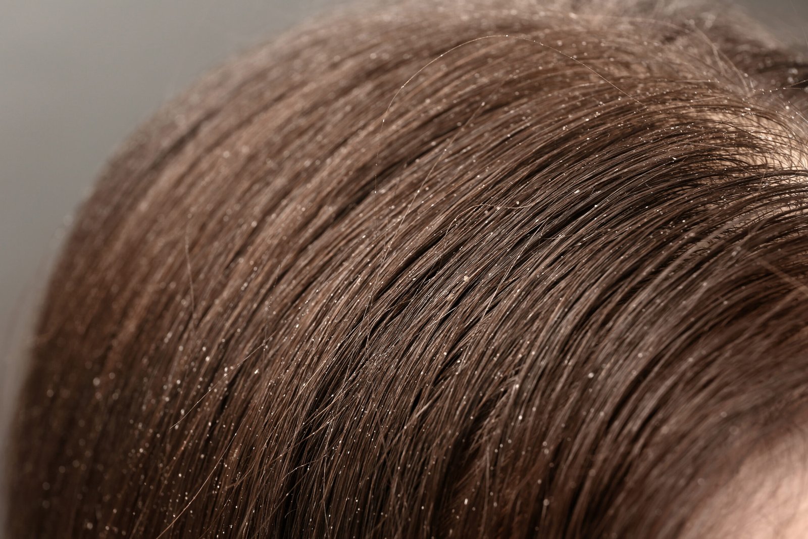 Itchy scalp with visible scaling