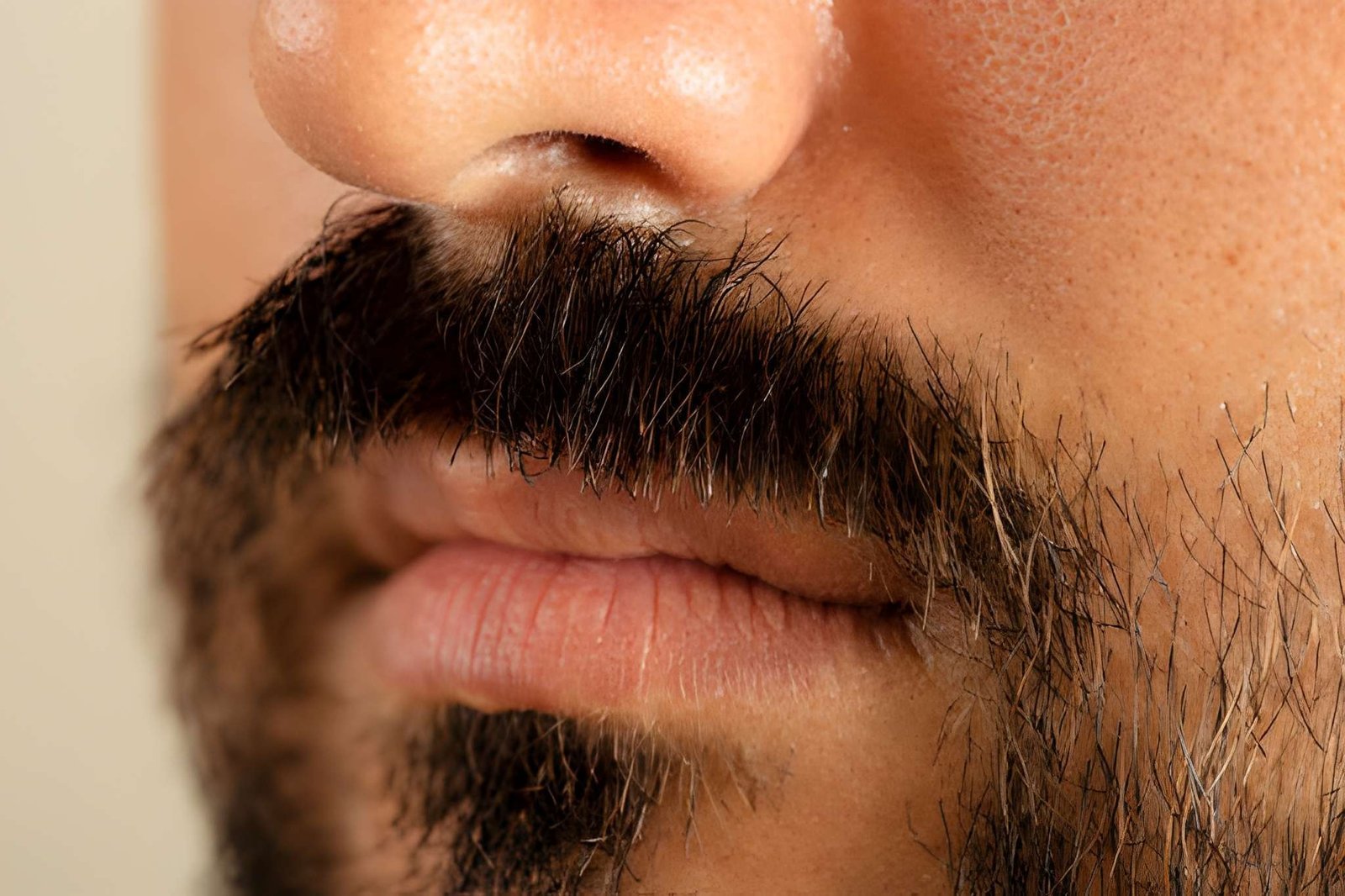 Moustache transplant in Delhi at Skinfollix