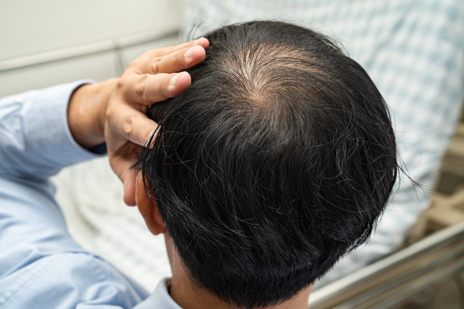 Non-surgical GFC hair treatment option for early hair thinning