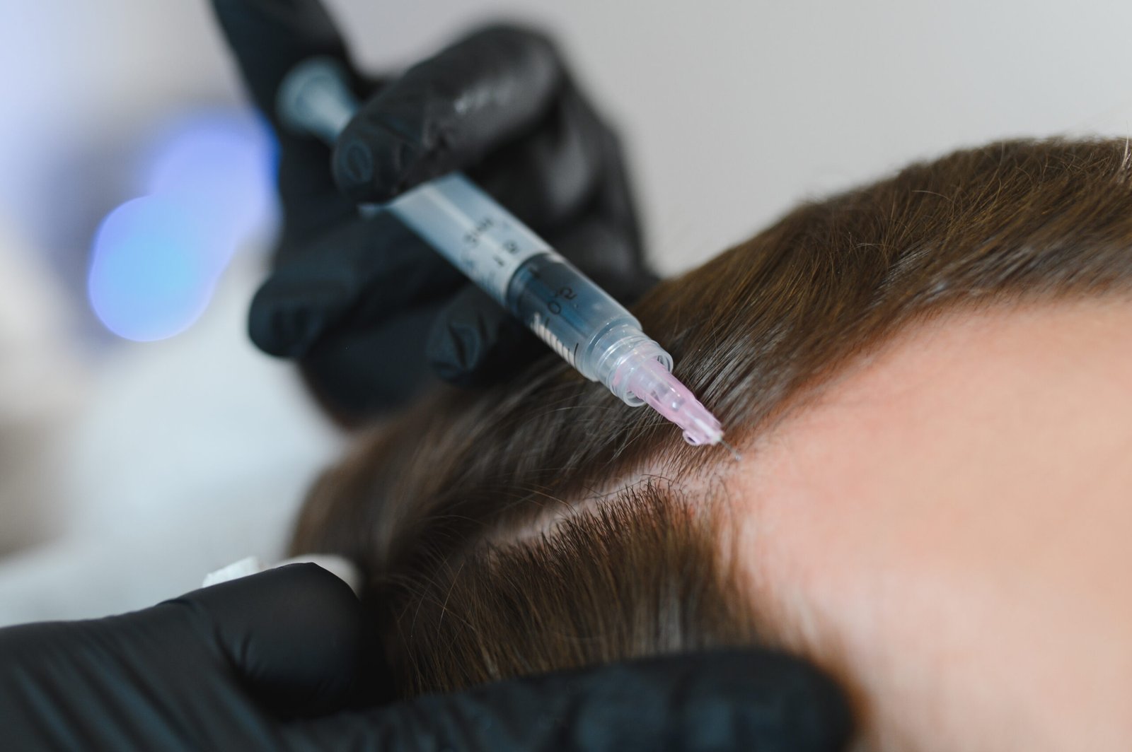PRP candidacy assessment and diagnosis at Skinfollix