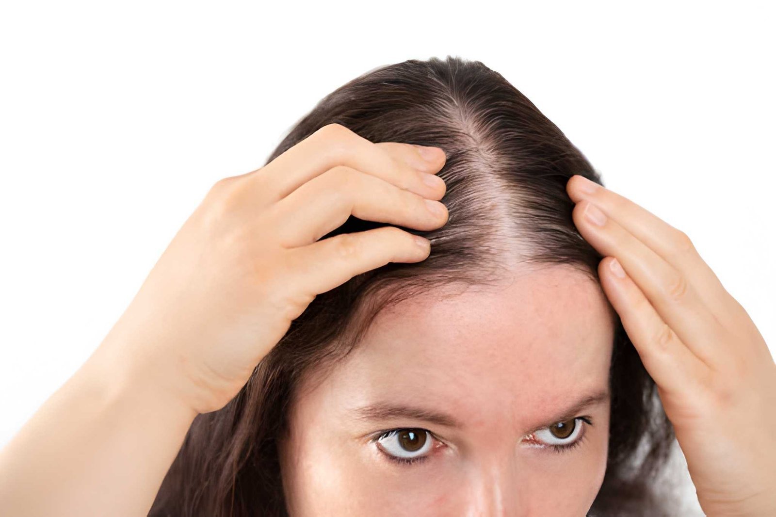 Postpartum hair loss and temporary shedding