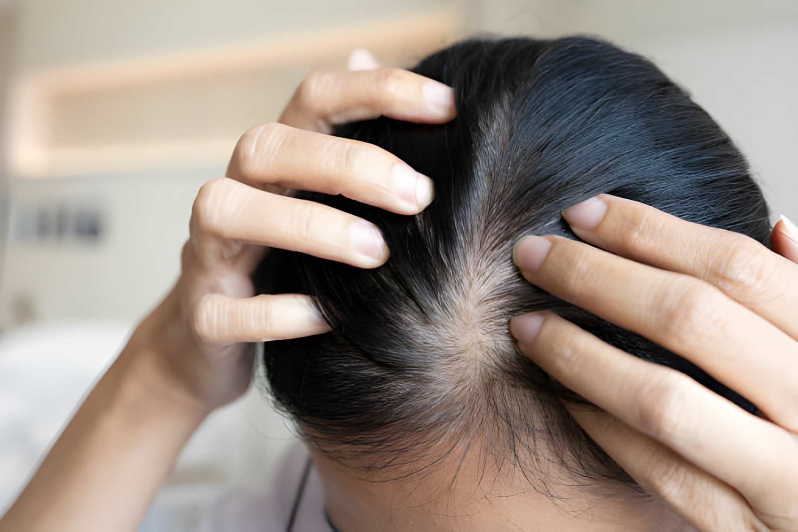 Scalp Diagnosis At Skinfollix