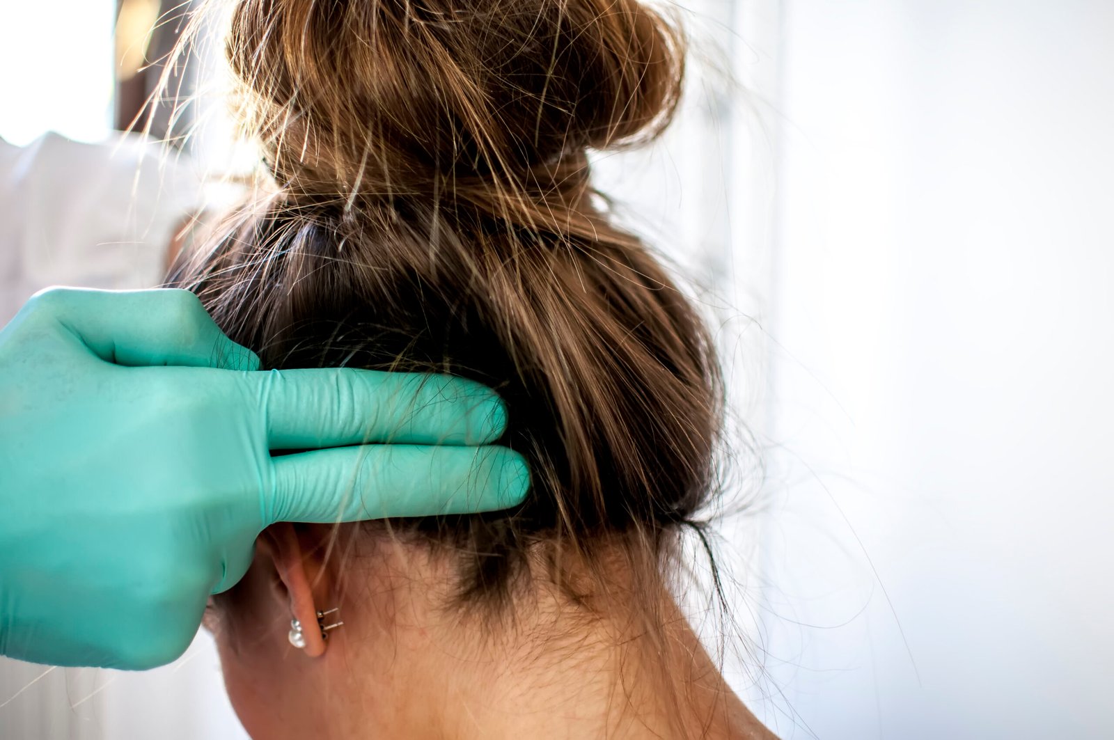 Scalp with visible scalp flakes