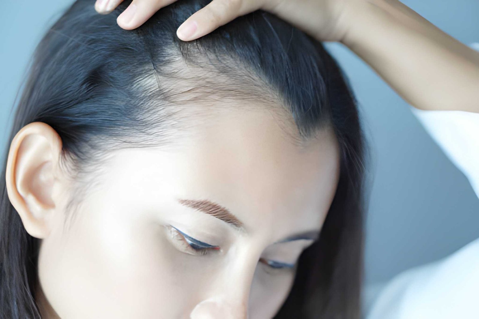 Seborrheic dermatitis and scalp care treatment in Delhi
