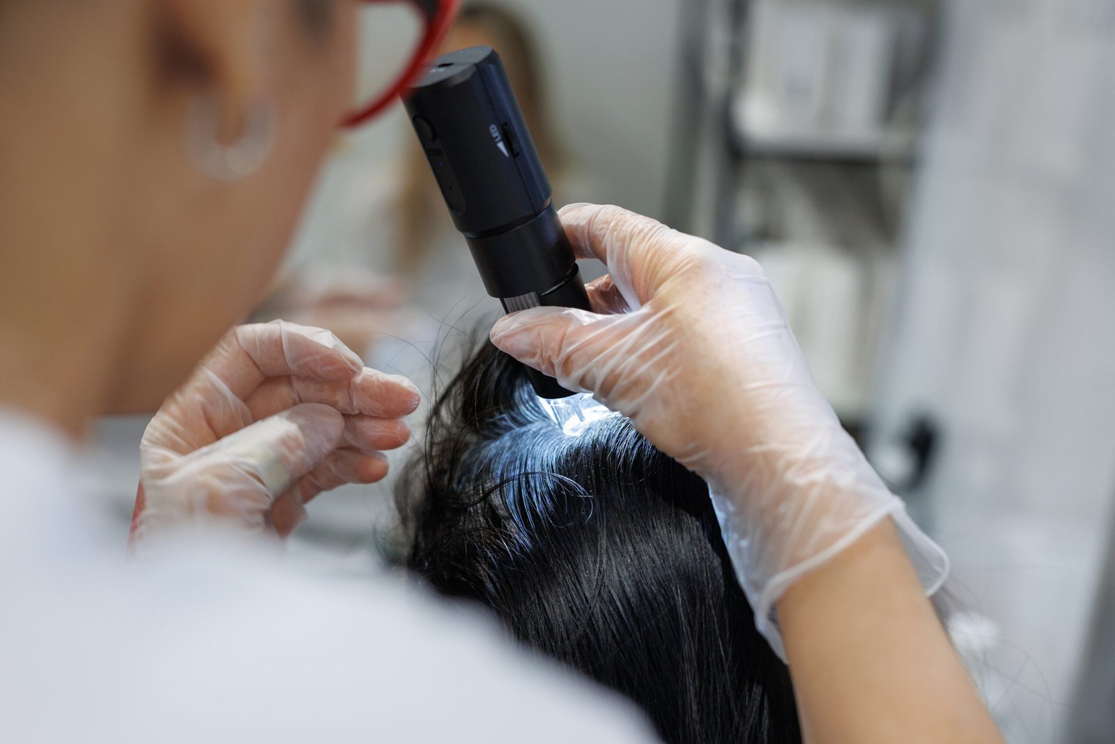 Severe scalp with extensive scalp scaling