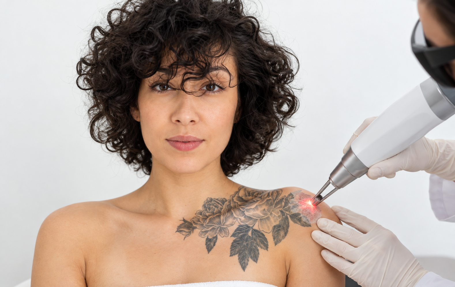 Laser tattoo removal for dull skin in Delhi at Skinfollix