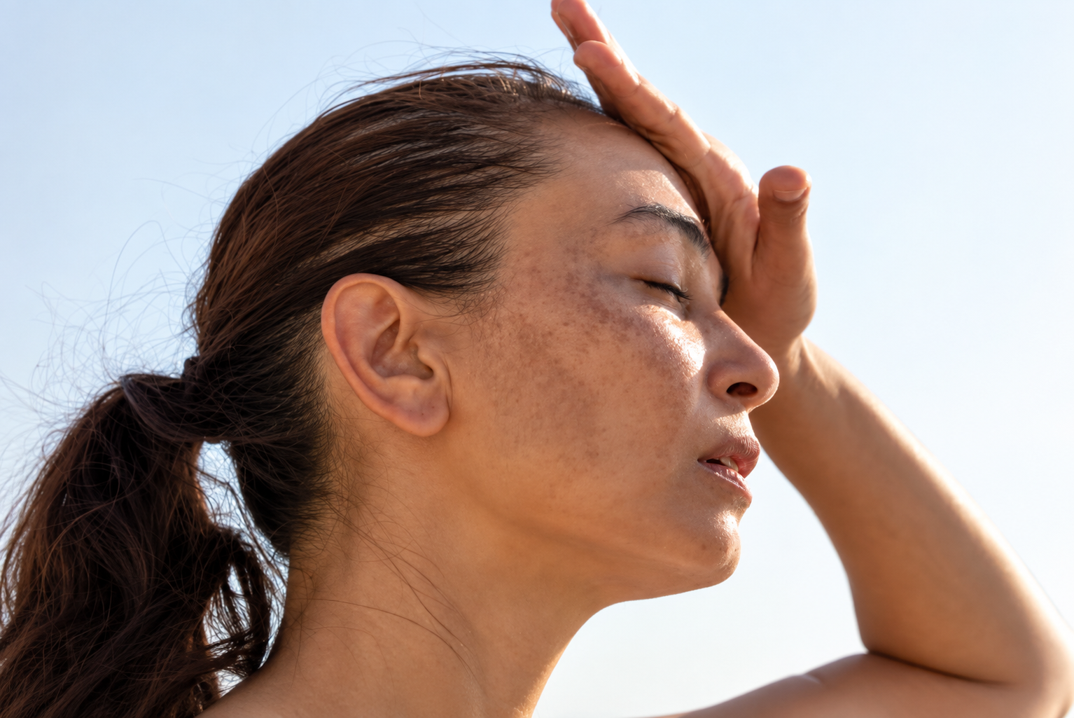 Laser skin pigmentation treatment for sun damage in Delhi at Skinfollix