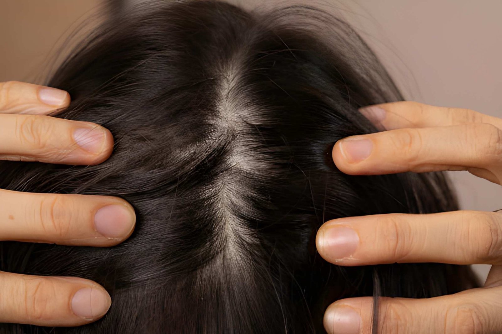 What Is Scalp